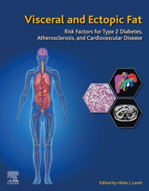 Hildo J. Lamb - Visceral and Ectopic Fat, E-bok