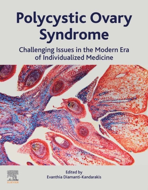 Evanthia Diamanti-Kandarakis - Polycystic Ovary Syndrome, E-bok