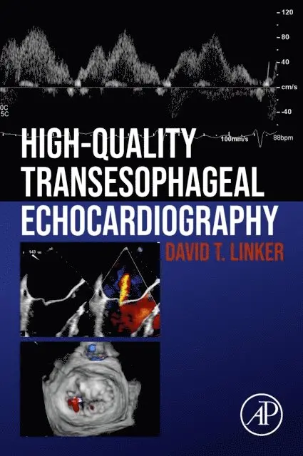 David T. Linker - High-Quality Transesophageal Echocardiography, E-bok. Tillgänglighet: Lägg i varukorg