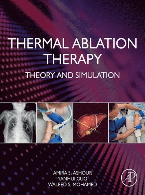 Waleed S. Mohamed, Yanhui Guo, Amira S. Ashour - Thermal Ablation Therapy, E-bok
