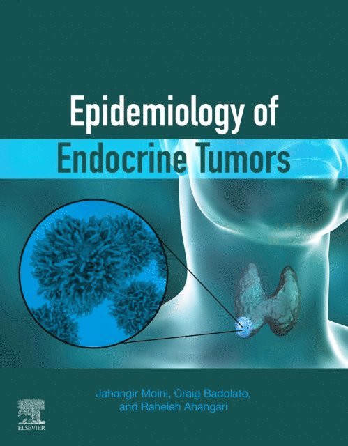 Raheleh Ahangari, Craig Badolato, Jahangir Moini - Epidemiology of Endocrine Tumors, E-bok