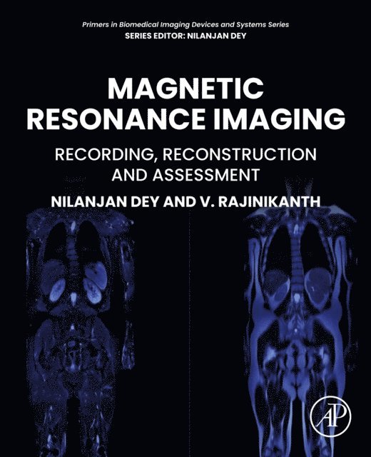 Nilanjan Dey, V. Rajinikanth - Magnetic Resonance Imaging, E-bok