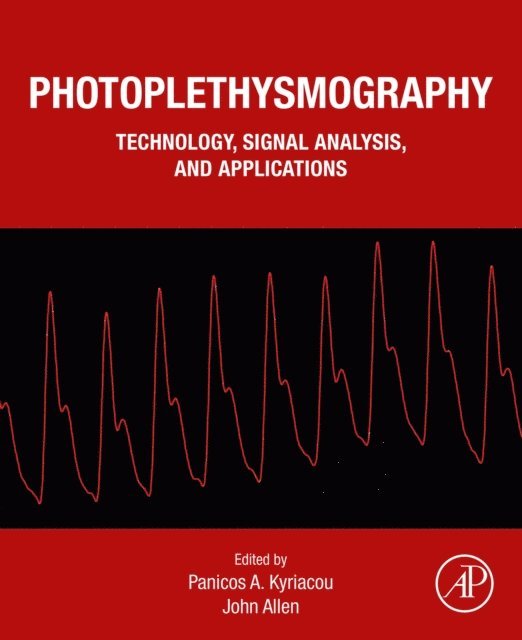 John Allen, Panicos A. Kyriacou - Photoplethysmography, E-bok