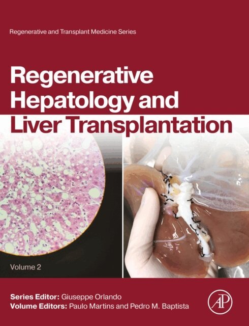 Pedro Baptista, Paulo Martins - Regenerative Hepatology and Liver Transplantation, E-bok