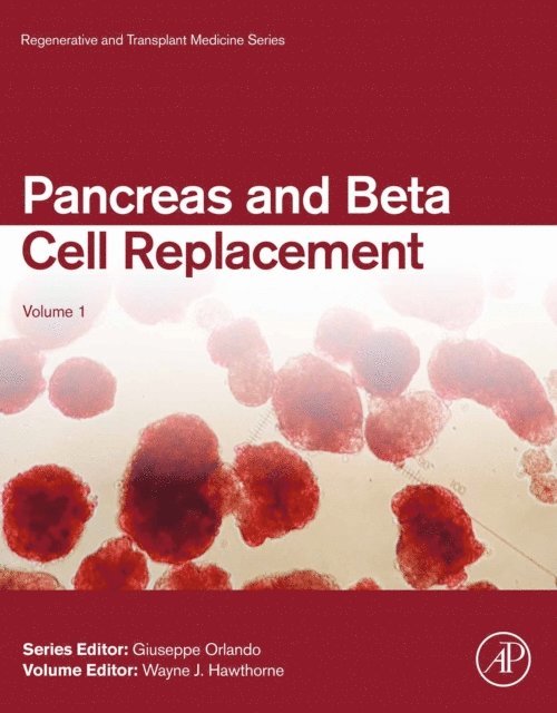 Wayne Hawthorne - Pancreas and Beta Cell Replacement, E-bok