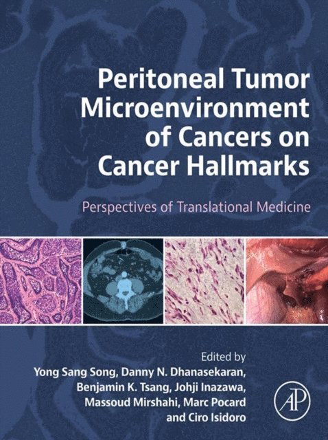 Ciro Isidoro, Marc Pocard, Massoud Mirshahi, Johji Inazawa, Benjamin K. Tsang, Danny N. Dhanasekaran, Yong Sang Song - Peritoneal Tumor Microenvironment of Cancers on Cancer Hallmarks, E-bok