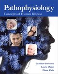 Pathophysiology