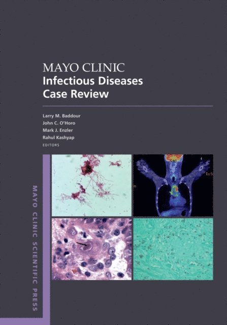 Rahul Kashyap, Mark J. Enzler, John C. O'Horo, Larry M. Baddour - Mayo Clinic Infectious Diseases Case Review, E-bok