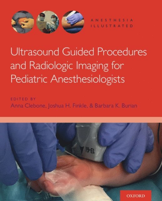 Barbara K. Burian, Keith J. Ruskin, Barbara K. Burian, Joshua H. Finkle, Anna Clebone - Ultrasound Guided Procedures and Radiologic Imaging for Pediatric Anesthesiologists, E-bok