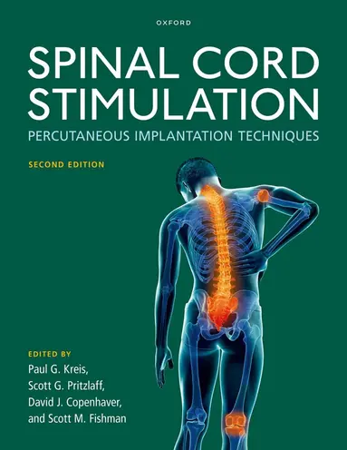 Spinal Cord Stimulation
