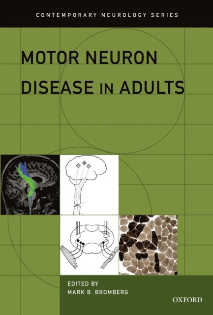 Mark Bromberg - Motor Neuron Disease in Adults, E-bok