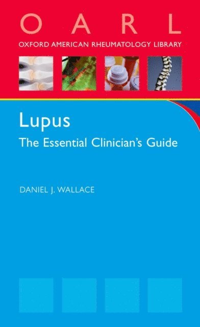 Daniel J Wallace - Lupus, E-bok