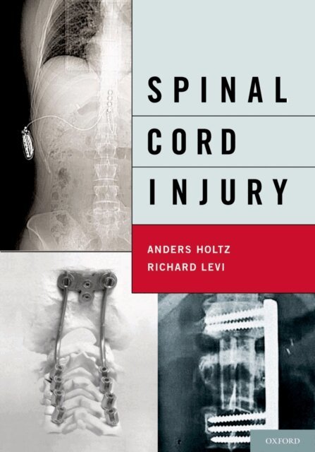 PhD Richard Levi, MD, PhD Anders Holtz, MD - Spinal Cord Injury, E-bok. Tillgänglighet: Lägg i varukorg