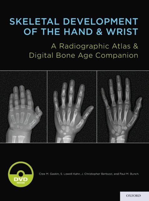 Paul M. Bunch, J. Christoper Bertozzi, MD MBA S. Lowell Kahn, Cree M. Gaskin - Skeletal Development of the Hand and Wrist, E-bok