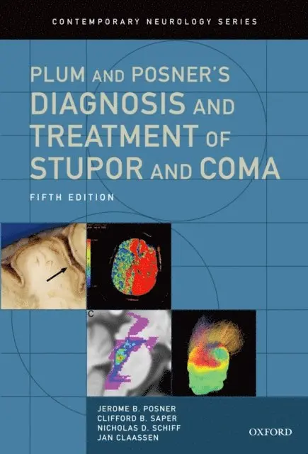 PhD Jan Claassen MD, Nicholas D. Schiff MD, PhD Clifford B. Saper MD, Jerome B. Posner MD - Plum and Posner's Diagnosis and Treatment of Stupor and Coma, E-bok. Tillgänglighet: Lägg i varukorg