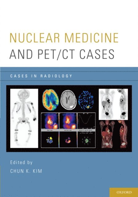 Chun K. Kim - Nuclear Medicine and PET/CT Cases, E-bok