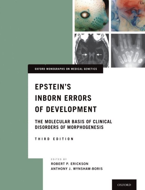 PhD Anthony J. Wynshaw-Boris MD, Robert P. Erickson MD - Epstein's Inborn Errors of Development, E-bok