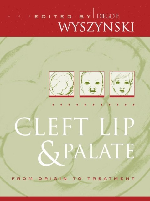 Diego F. Wyszynski - Cleft Lip and Palate, E-bok