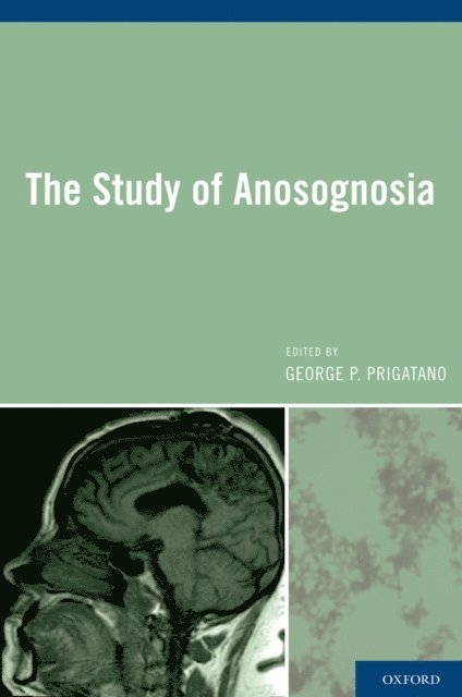 George P. Prigatano - Study of Anosognosia, E-bok