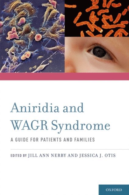 Jessca Otis, Jill Ann Nerby - Aniridia and WAGR Syndrome, E-bok