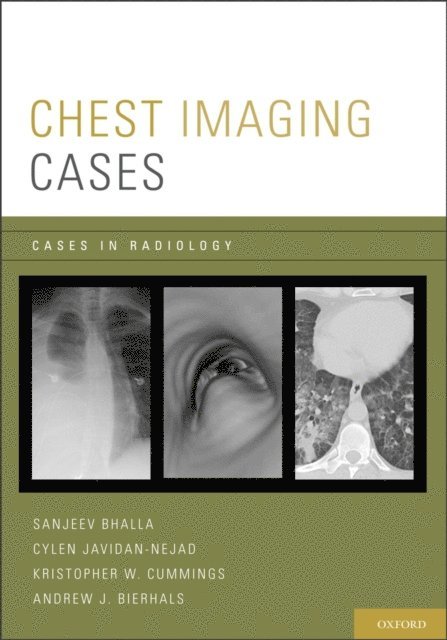 Andrew J. Bierhals, Kristopher W. Cummings, Cylen Javidan-Nejad, Sanjeev Bhalla - Chest Imaging Cases, E-bok