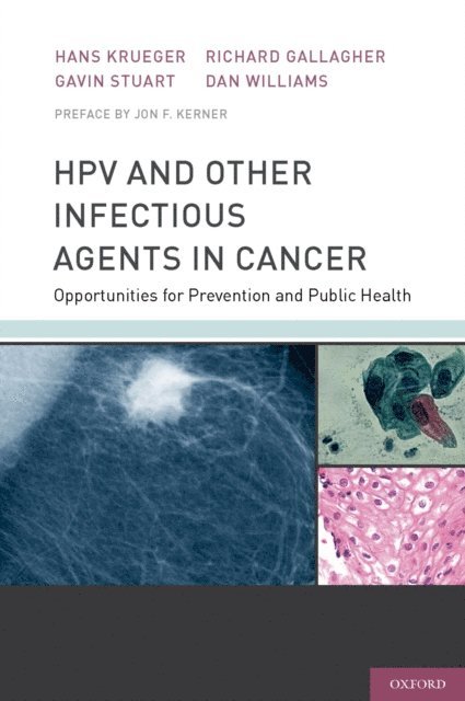 Dan Williams, Richard Gallagher, Gavin Stuart, Hans Krueger - HPV and Other Infectious Agents in Cancer, E-bok