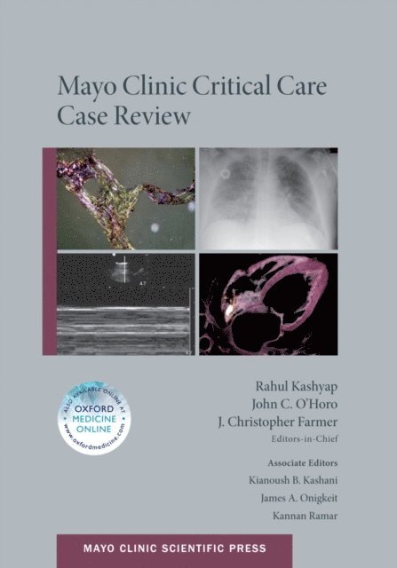 J. Christopher Farmer MD, MPH John C. O'Horo MD, Rahul Kashyap MBBS - Mayo Clinic Critical Care Case Review, E-bok
