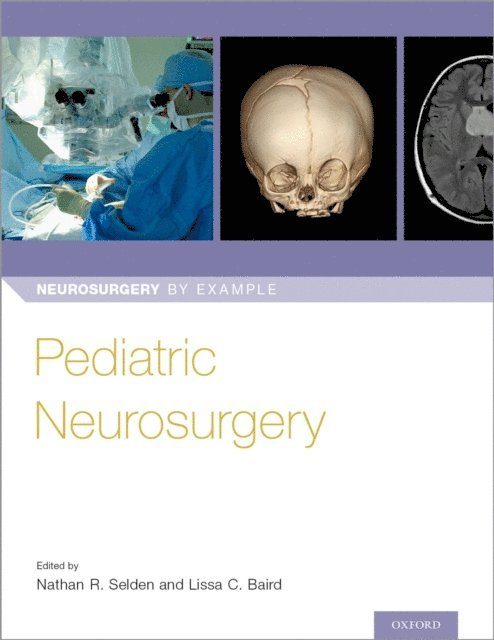Dr Lissa Baird, Dr Nathan Selden - Pediatric Neurosurgery, E-bok. Tillgänglighet: Lägg i varukorg
