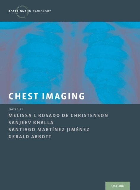 Santiago Martinez-Jimenez, Gerald Abbott, Sanjeev Bhalla, Melissa Rosado de Christensen - Chest Imaging, E-bok
