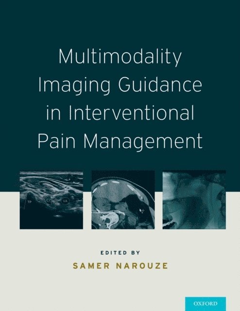 Samer N. Narouze - Multimodality Imaging Guidance in Interventional Pain Management, E-bok