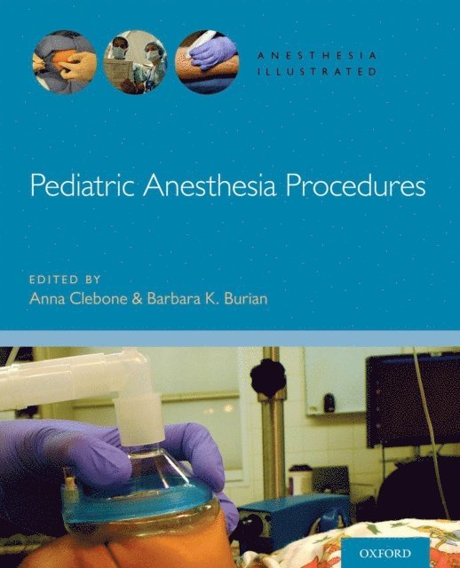 Keith J. Ruskin, Barbara Burian, Anna Clebone - Pediatric Anesthesia Procedures, E-bok