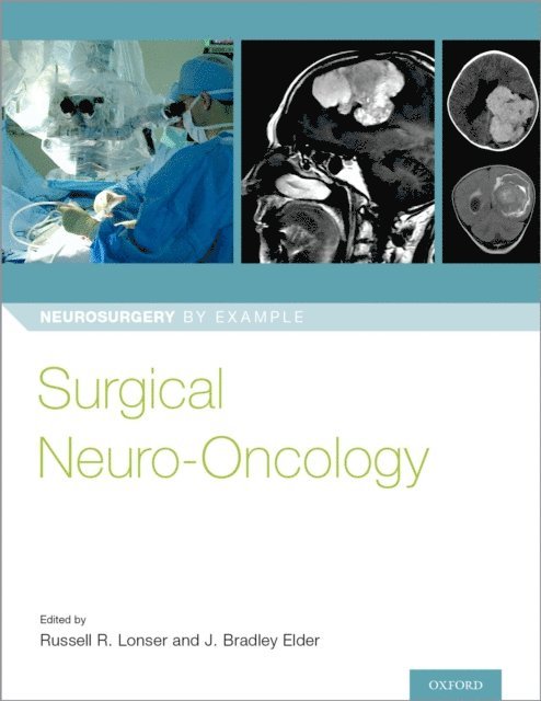 J. Bradley Elder, Russell R. Lonser - Surgical Neuro-Oncology, E-bok