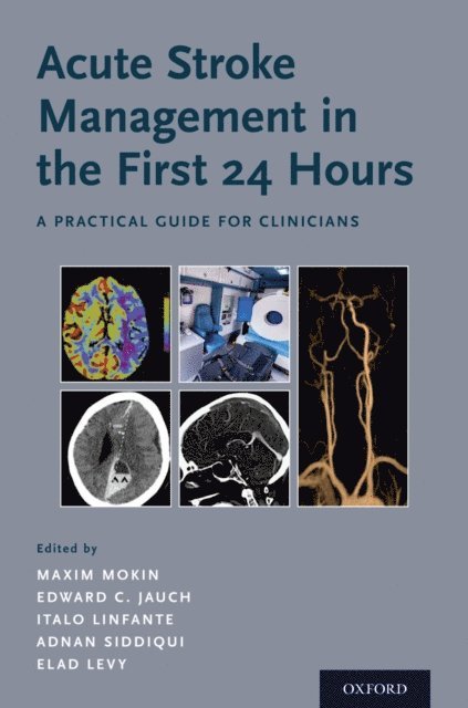 Elad Levy, Adnan Siddiqui, Italo Linfante, Edward C. Jauch, Maxim Mokin - Acute Stroke Management in the First 24 Hours, E-bok