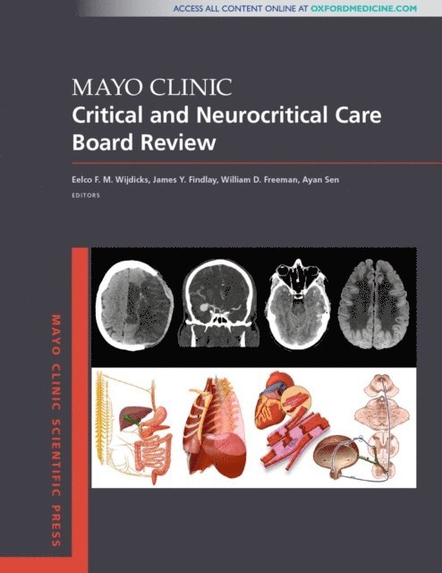 FACEP Ayan Sen MD, MSc, FCCP, FNCS William D. Freeman MD, James Y. Findlay MB,ChB, PhD Eelco F.M. Wijdicks MD - Mayo Clinic Critical and Neurocritical Care Board Review, E-bok. Tillgänglighet: Lägg i varukorg