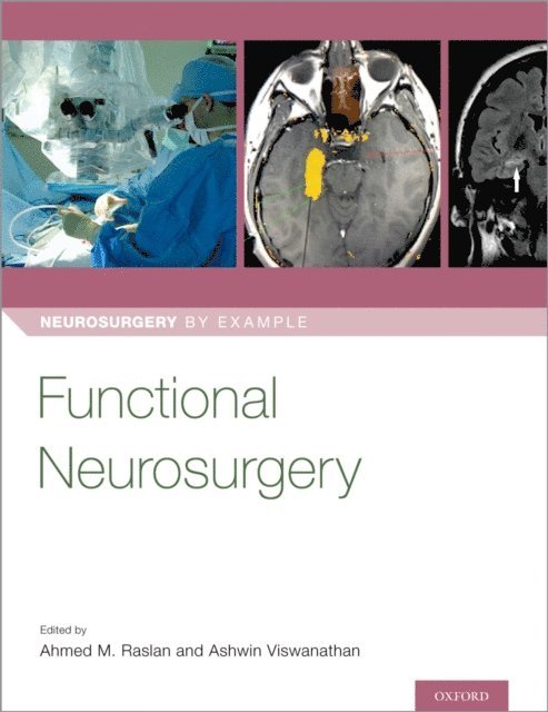 Ashwin Viswanathan, Dr. Ahmed Raslan - Functional Neurosurgery, E-bok
