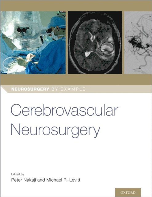 Dr Michael Levitt, Dr Peter Nakaji - Cerebrovascular Neurosurgery, E-bok