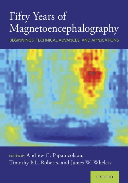 James W. Wheless, Timothy P.L. Roberts, Andrew C. Papanicolaou - Fifty Years of Magnetoencephalography, E-bok