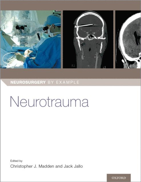 Jack Jallo, Christopher J. Madden - Neurotrauma, E-bok