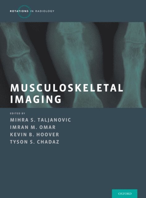 Tyson S. Chadaz, Kevin B. Hoover, Imran M. Omar, Mihra S. Taljanovic - Musculoskeletal Imaging 2 Vol Set, E-bok
