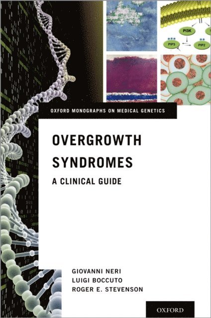 Roger E. Stevenson, Luigi Boccuto, Giovanni Neri - Overgrowth Syndromes, E-bok