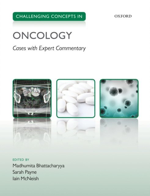 Iain McNeish, Sarah Payne, Madhumita Bhattacharyya - Challenging Concepts in Oncology, E-bok