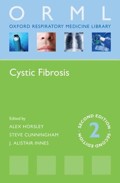 J Alastair Innes, Steve Cunningham, Alex Horsley - Cystic Fibrosis, E-bok