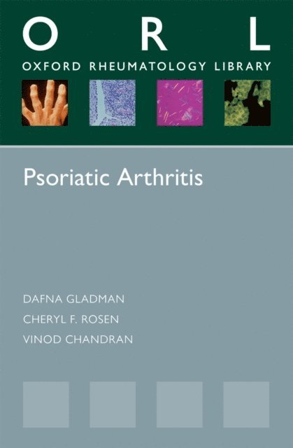 Vinod Chandran, Cheryl F. Rosen, Dafna Gladman - Psoriatic Arthritis, E-bok