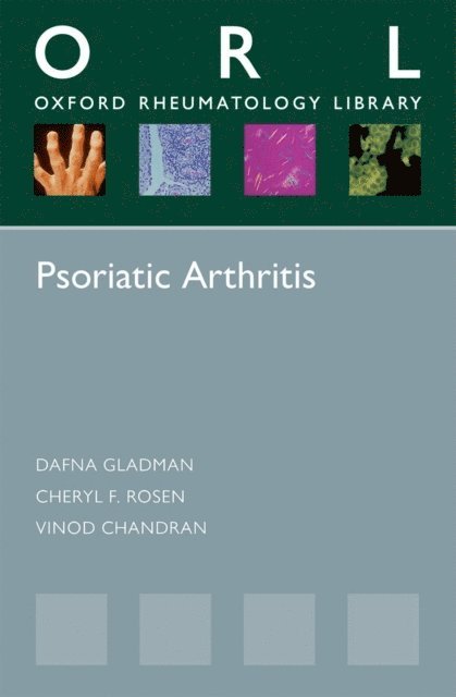 Vinod Chandran, Cheryl F. Rosen, Dafna Gladman - Psoriatic Arthritis, E-bok