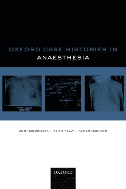 Keith Kelly, Jon McCormack - Oxford Case Histories in Anaesthesia, E-bok