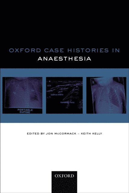 Keith Kelly, Jon McCormack - Oxford Case Histories in Anaesthesia, E-bok