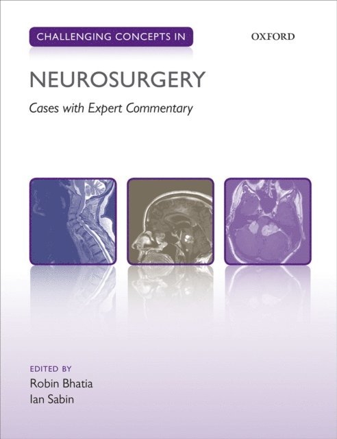 Ian Sabin, Robin Bhatia - Challenging Concepts in Neurosurgery, E-bok