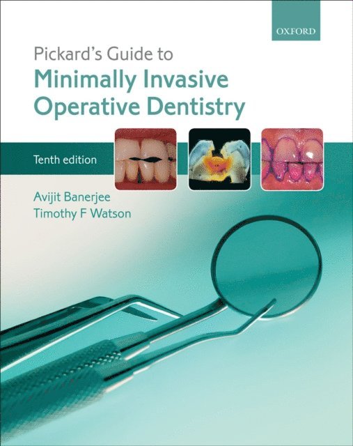 Timothy F. Watson, Avijit Banerjee - Pickard's Guide to Minimally Invasive Operative Dentistry, E-bok. Tillgänglighet: Lägg i varukorg
