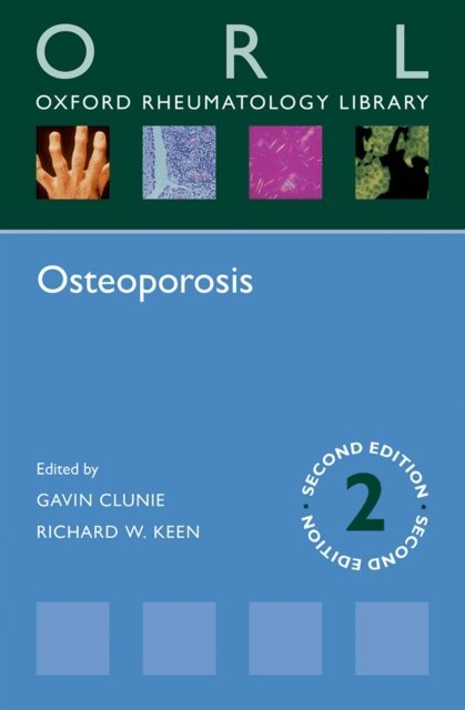 Richard W. Keen, Gavin Clunie - Osteoporosis, E-bok