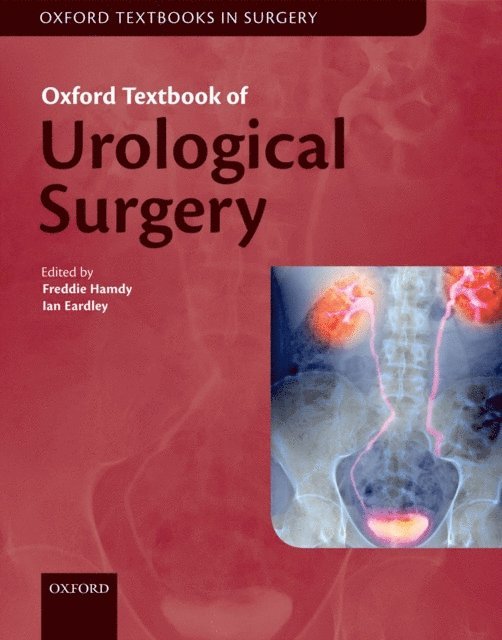 Ian Eardley, Freddie C. Hamdy - Oxford Textbook of Urological Surgery, E-bok